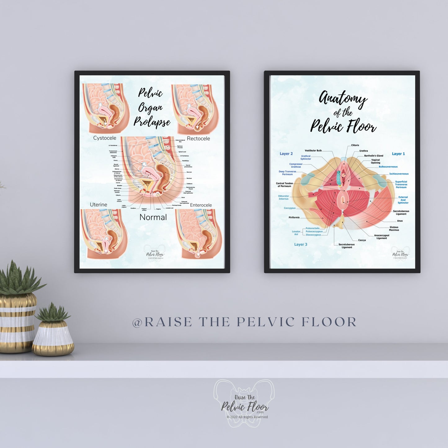 Prolapse Bladder, Rectum, Uterus, Intestine Art Print | Cystocele, Rectocele, Uterine Prolapse and Enterocele | Pelvic Floor
