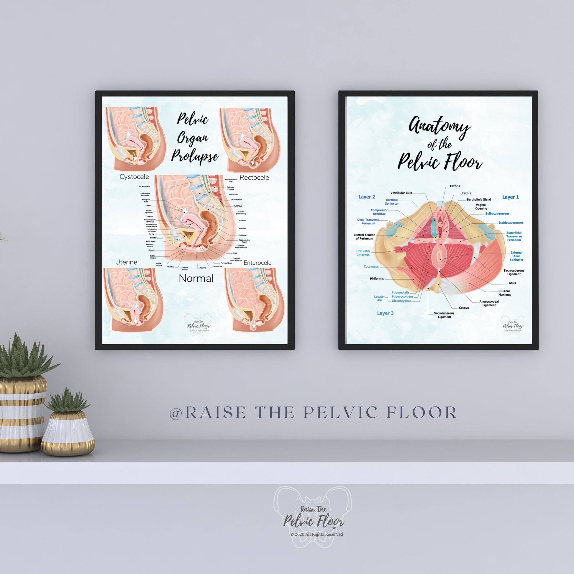 Prolapse Bladder, Rectum, Uterus, Intestine Art Print | Cystocele, Rectocele, Uterine Prolapse and Enterocele | Pelvic Floor