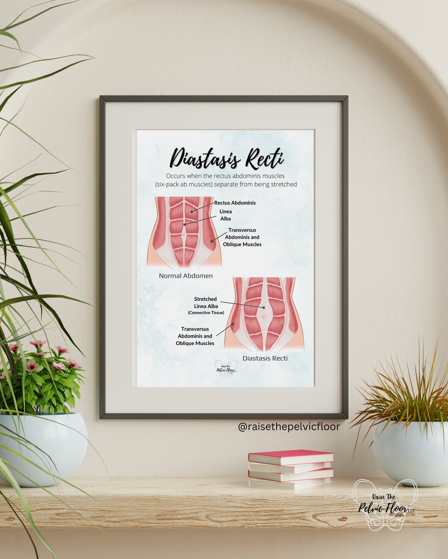 Diastasis Recti Pelvic Floor Art Poster | Postpartum, Pregnancy, Pelvic Floor Physical Therapist | Pelvic floor anatomy health