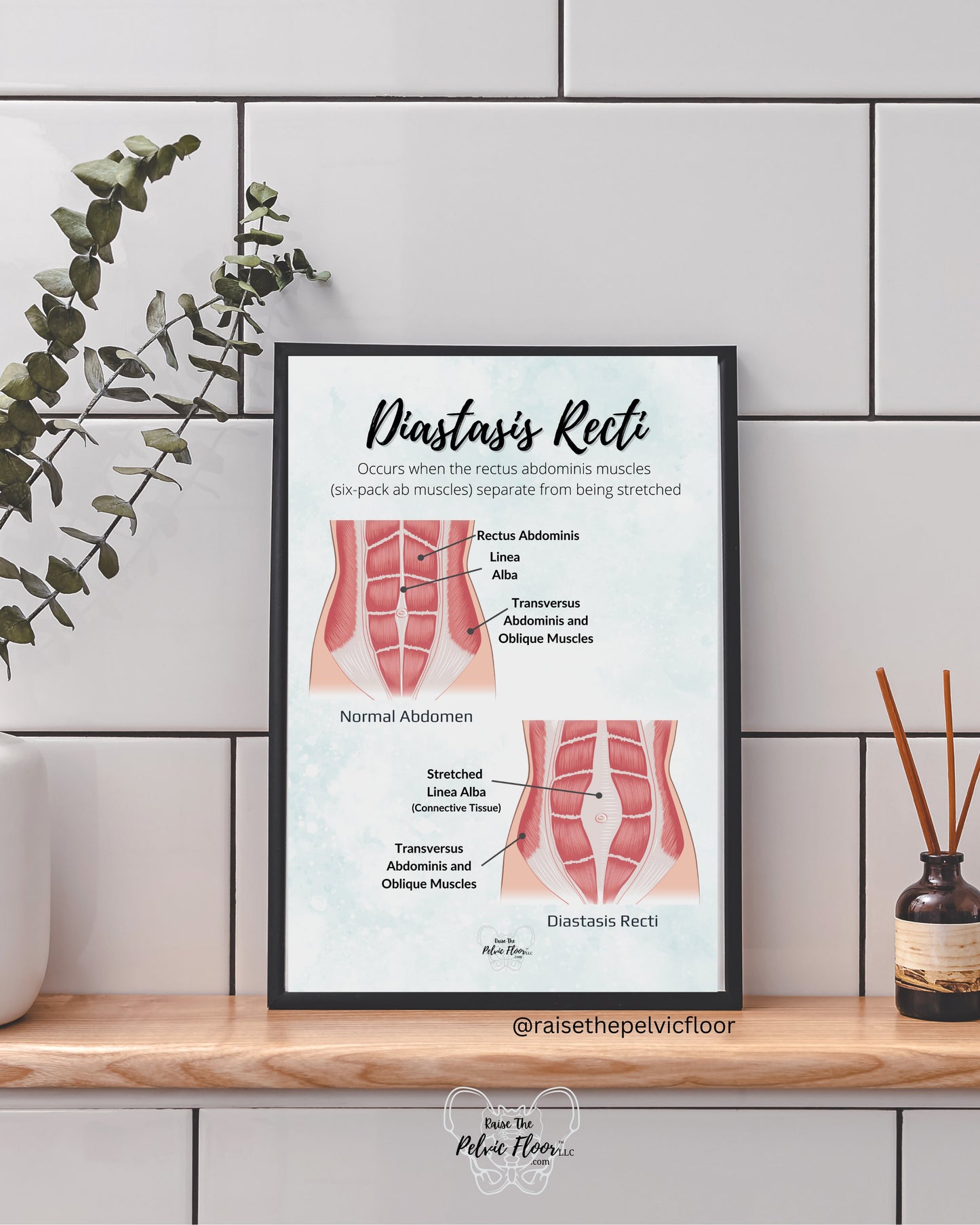 Diastasis Recti Pelvic Floor Art Poster | Postpartum, Pregnancy, Pelvic Floor Physical Therapist | Pelvic floor anatomy health