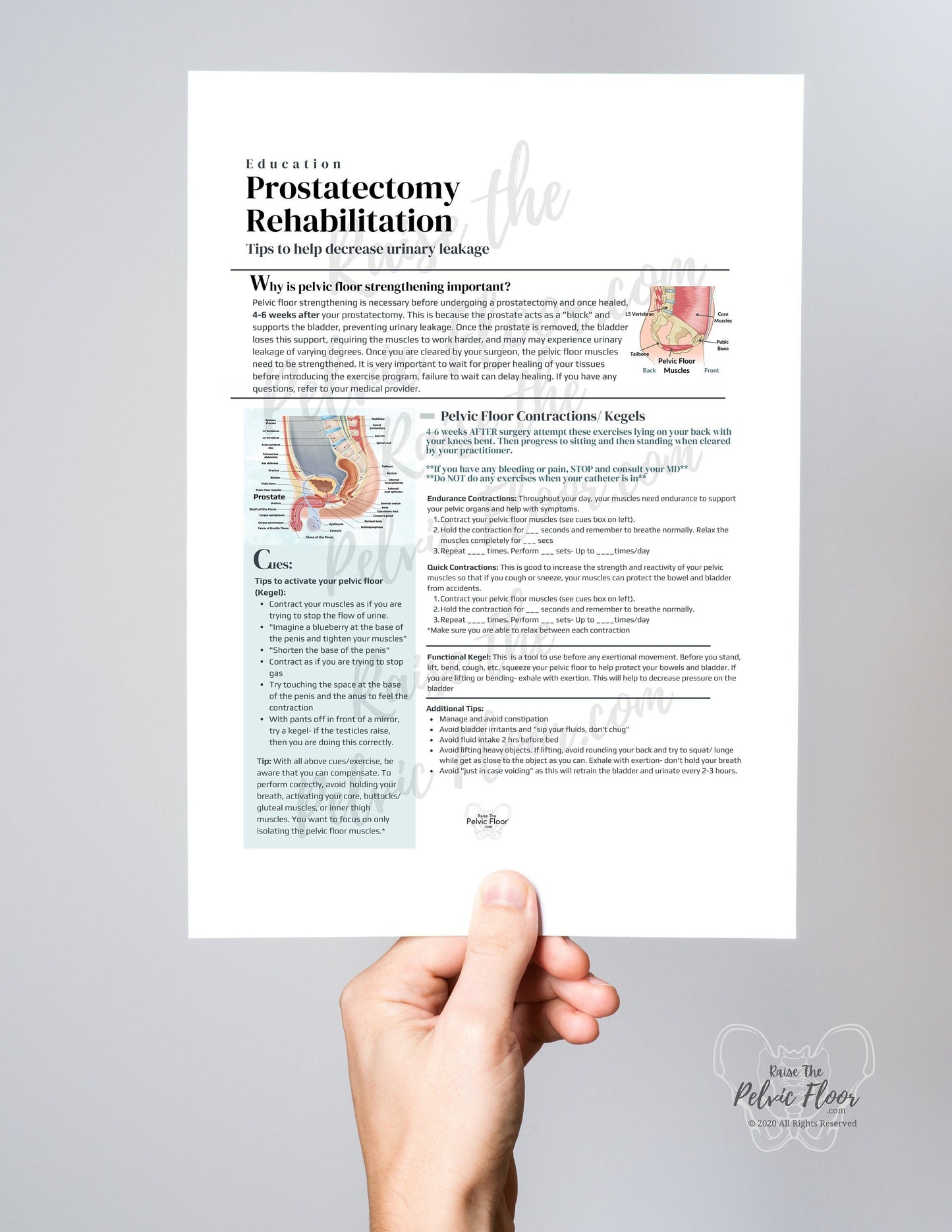 Prostatectomy Rehabilitation *Digital Download* Patient Education Handout- Pelvic Health, Prostate, Prostatectomy, Penis, Urine Leakage