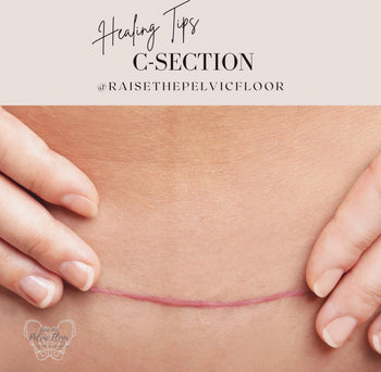 C-section cuts 6 layers? – Raise The Pelvic Floor