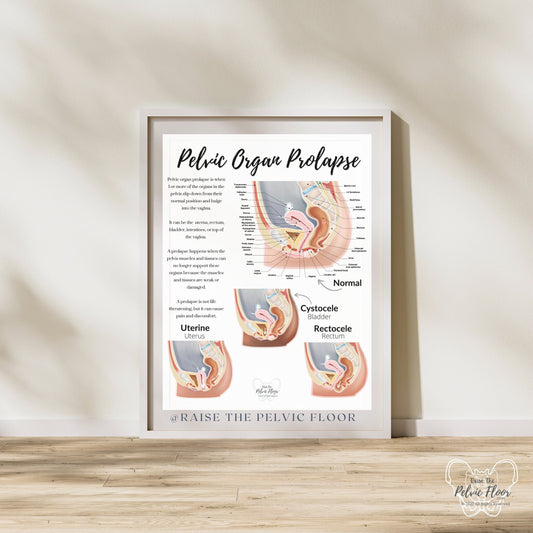 Prolapse Definition Art Print of Bladder, Rectum, & Uterus | Cystocele, Rectocele, and Uterine Prolapse | Pelvic Floor *Cultural Diversity