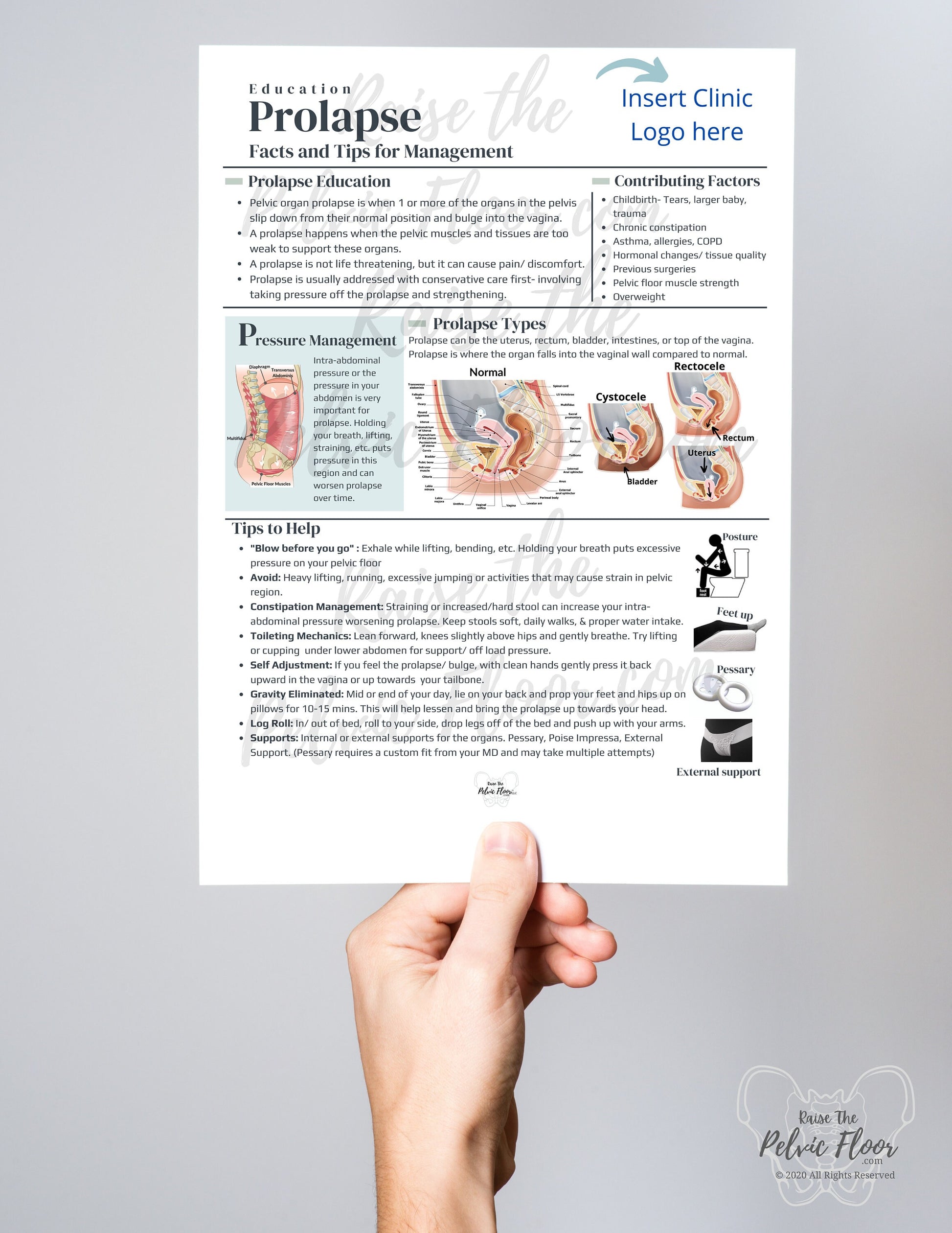 DIGITAL DOWNLOAD* Prolapse Patient Education Handout | Rectocele, Cystocele, Uterine Bulge 8.5 x11" Handout Info | Pelvic Floor Health