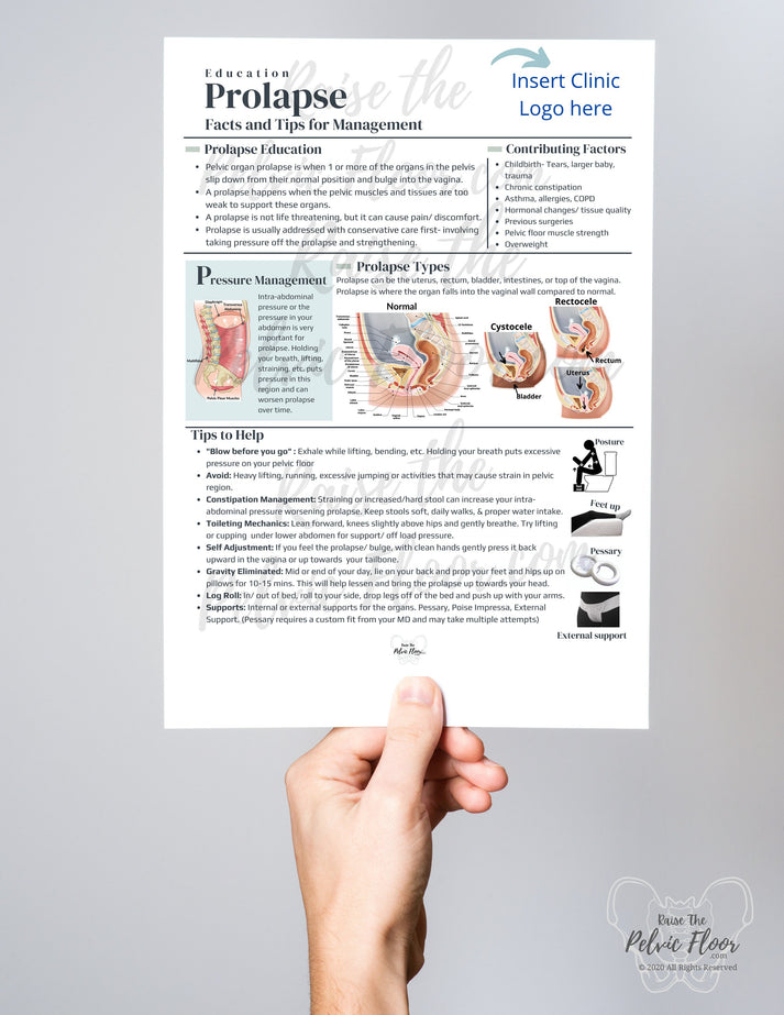 DIGITAL DOWNLOAD* Prolapse Patient Education Handout | Rectocele, Cyst ...