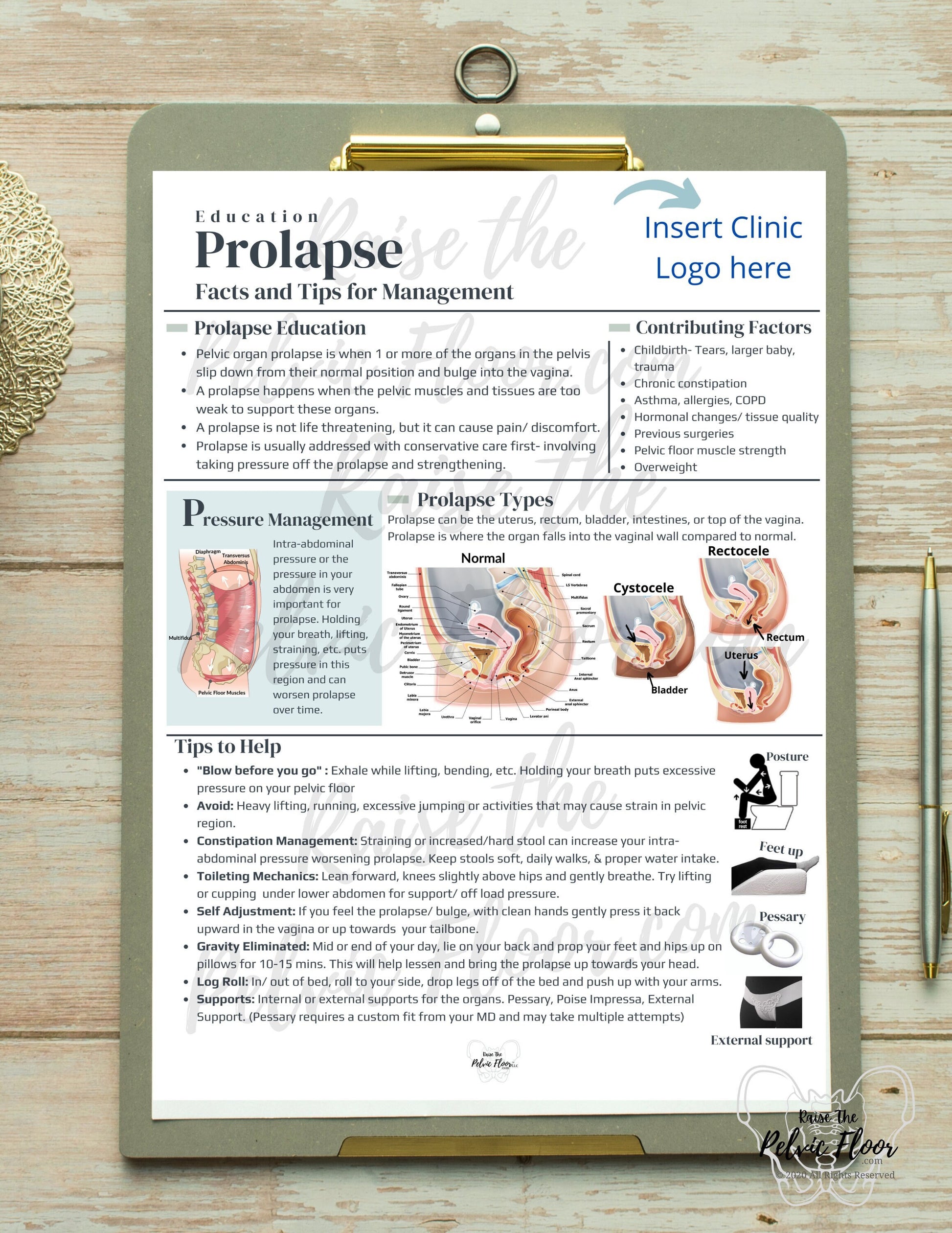DIGITAL DOWNLOAD* Prolapse Patient Education Handout | Rectocele, Cystocele, Uterine Bulge 8.5 x11" Handout Info | Pelvic Floor Health