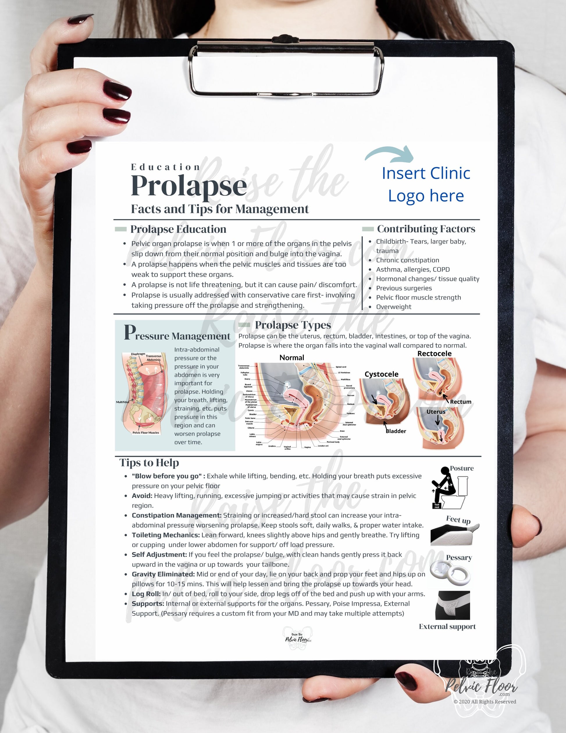 DIGITAL DOWNLOAD* Prolapse Patient Education Handout | Rectocele, Cystocele, Uterine Bulge 8.5 x11" Handout Info | Pelvic Floor Health