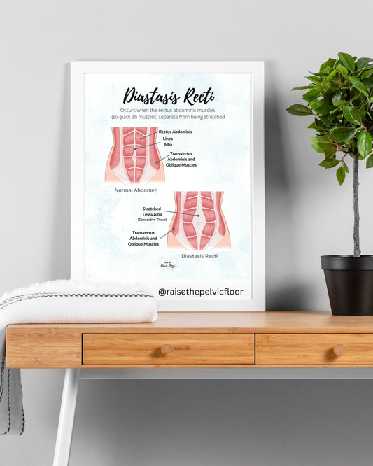 Diastasis Recti Pelvic Floor Art Poster | Postpartum, Pregnancy, Pelvic Floor Physical Therapist | Pelvic floor anatomy health