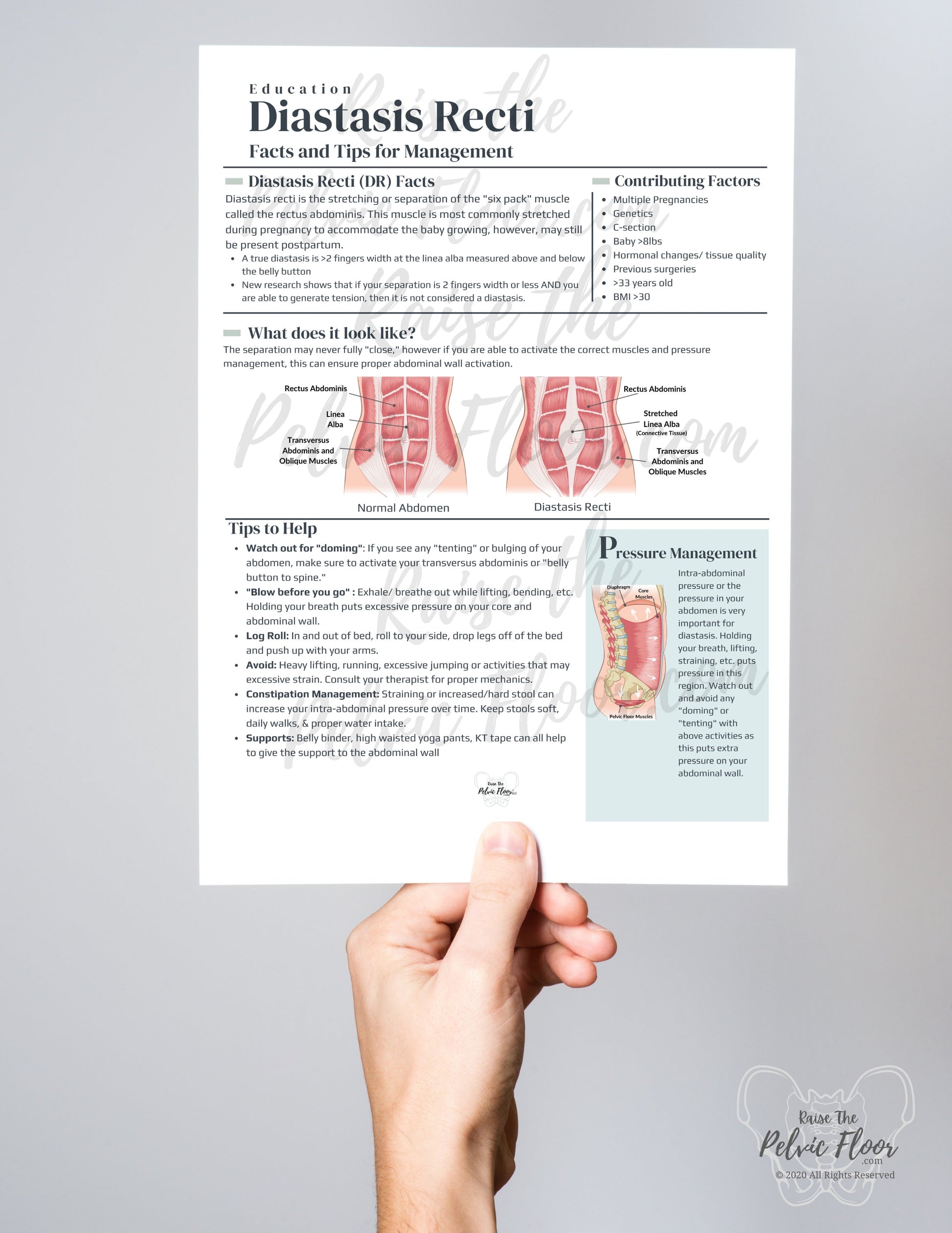 Diastasis Recti Patient Education Handout PDF Digital Download | Postpartum Core Muscles- Pelvic Floor Health Practitioner resource flyer