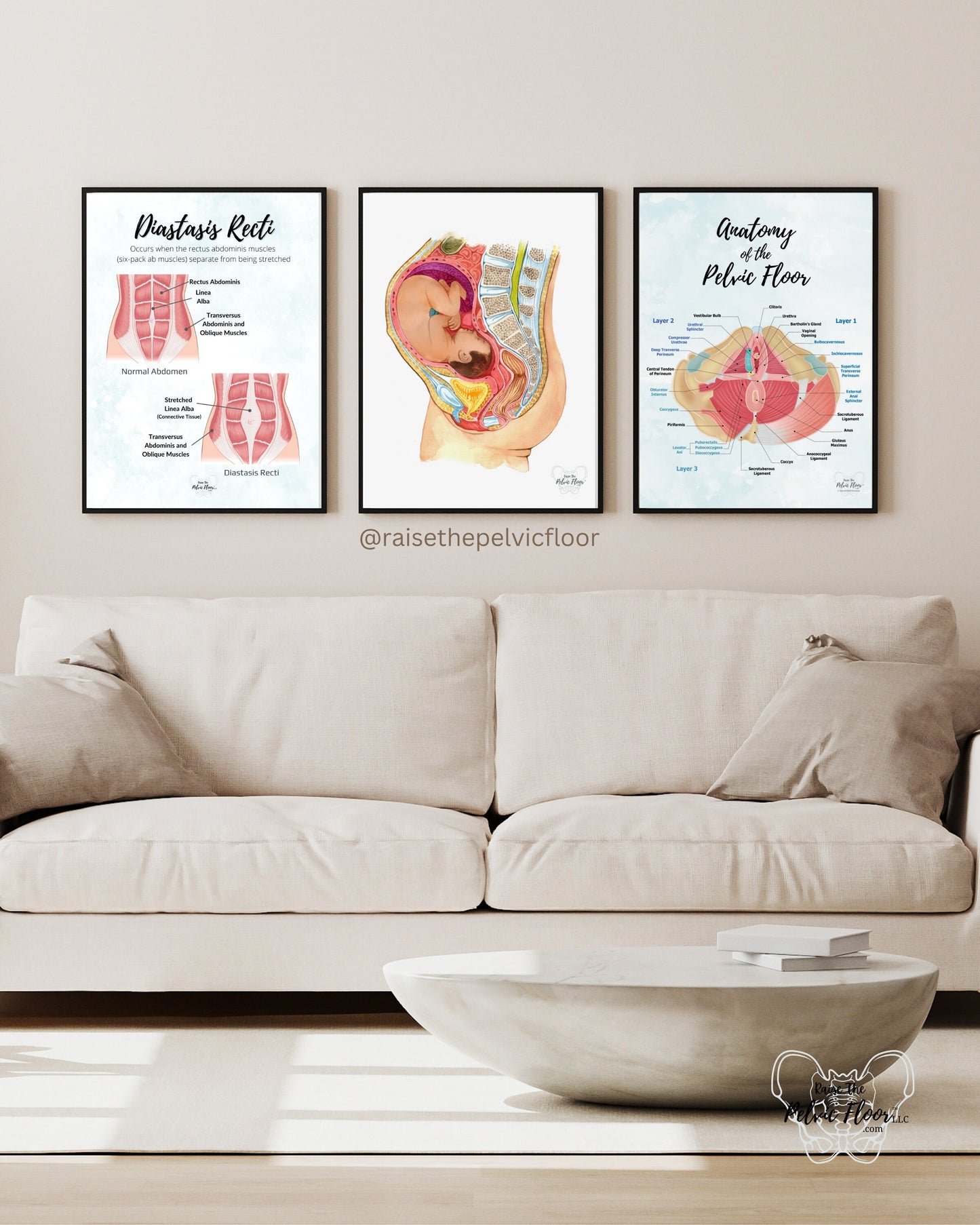 Diastasis Recti Pelvic Floor Art Poster | Postpartum, Pregnancy, Pelvic Floor Physical Therapist | Pelvic floor anatomy health