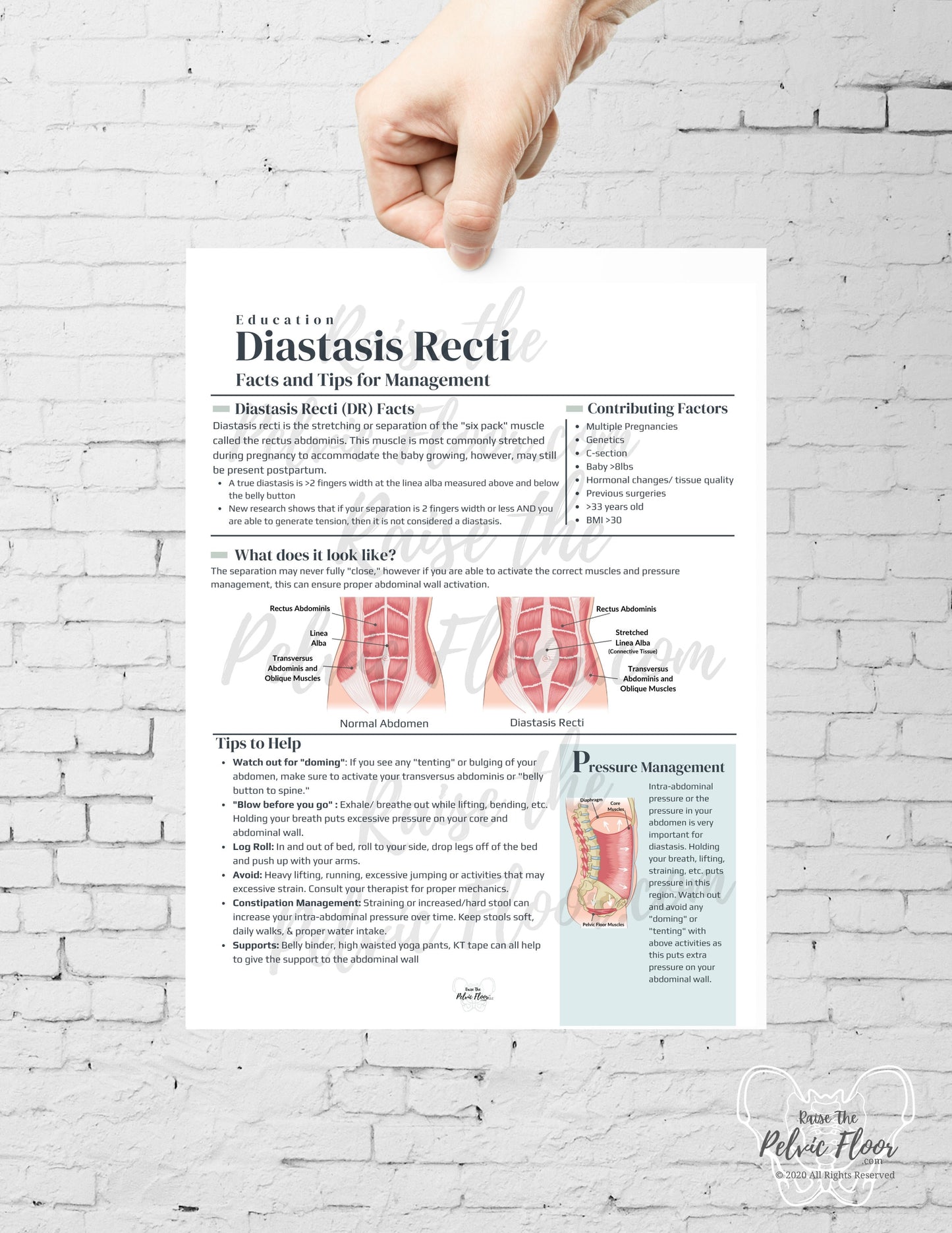 Diastasis Recti Patient Education Handout PDF Digital Download | Postpartum Core Muscles- Pelvic Floor Health Practitioner resource flyer