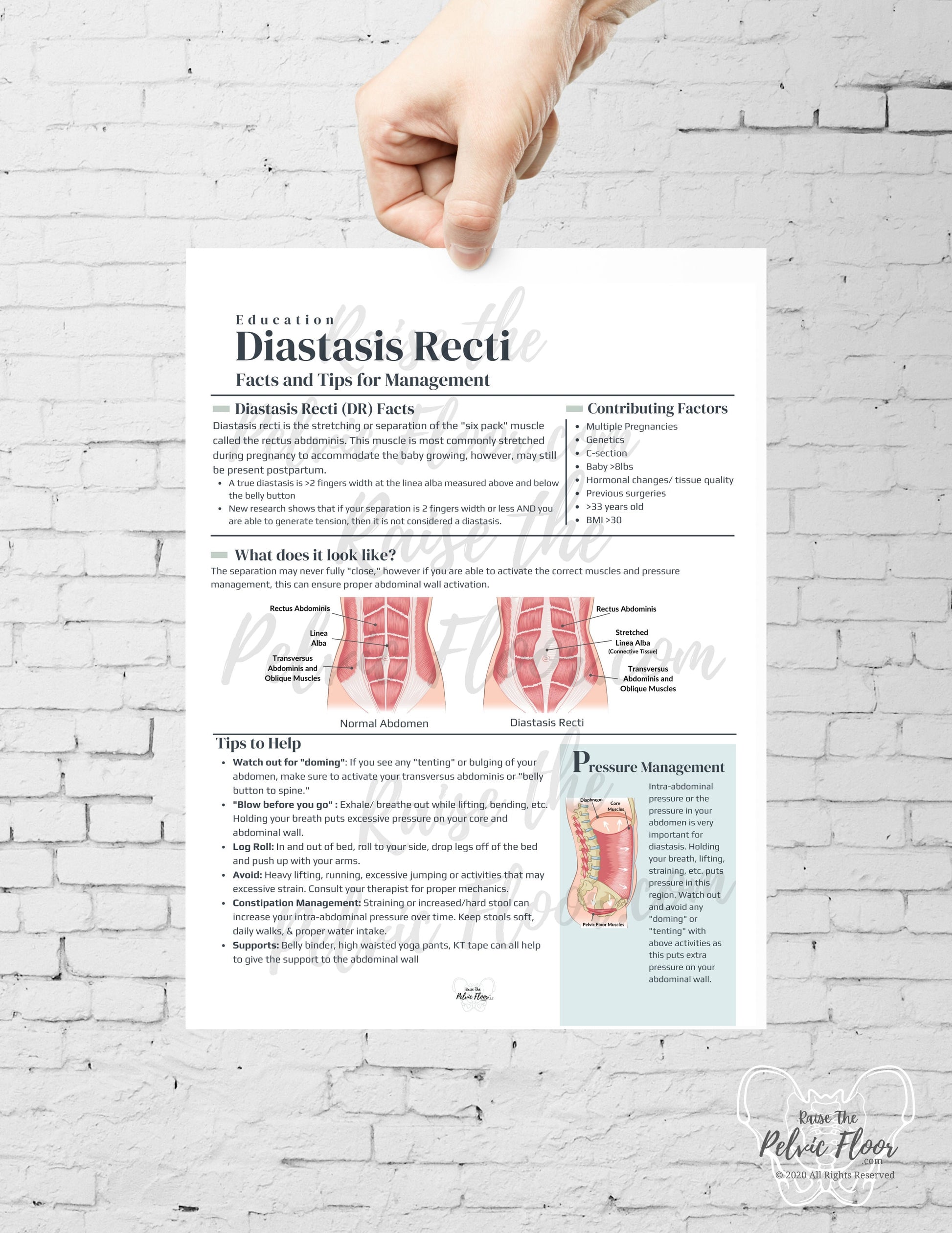 Diastasis Recti Patient Education Handout PDF Digital Download | Postpartum Core Muscles- Pelvic Floor Health Practitioner resource flyer