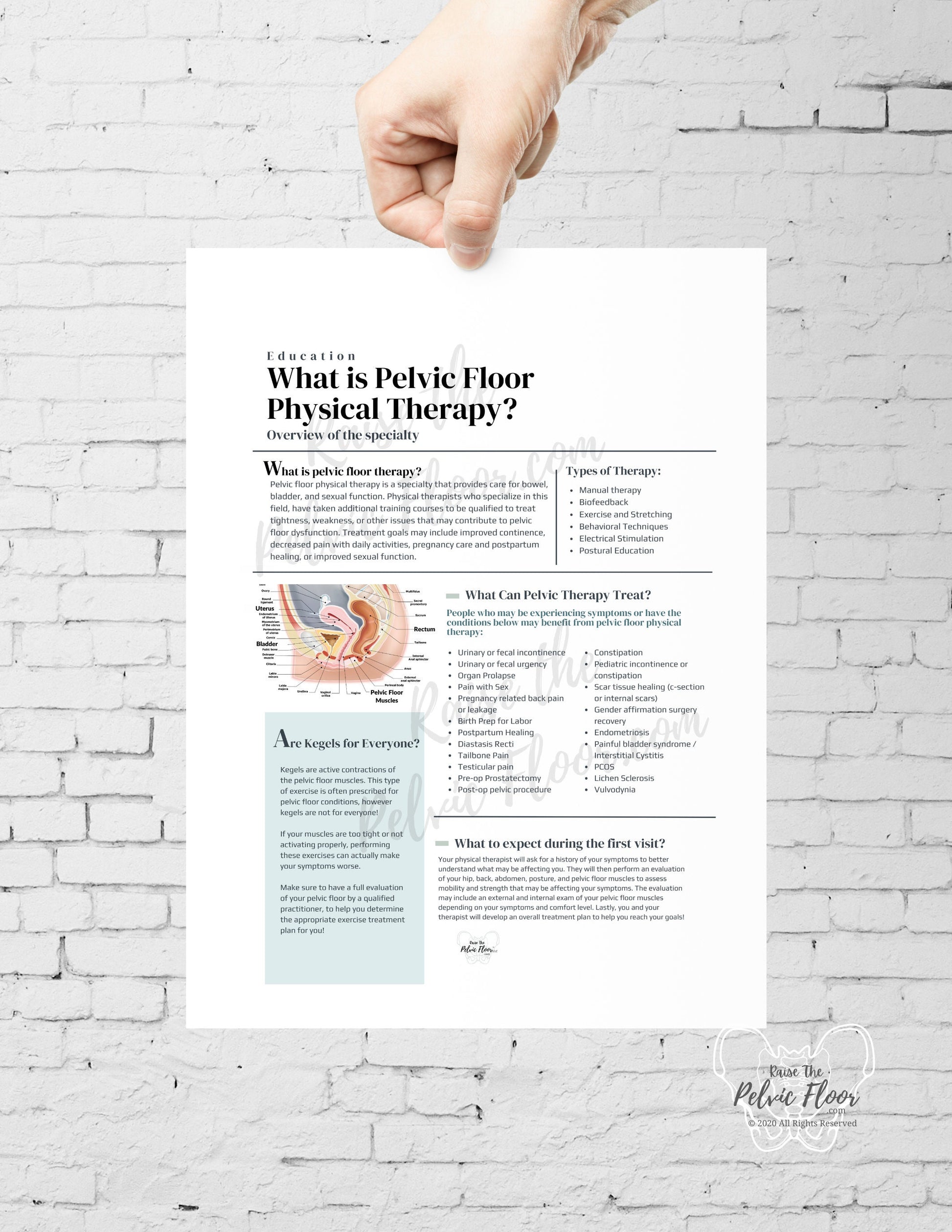 What is Pelvic Floor Physical Therapy Handout | *DIGITAL DOWNLOAD* Patient Education and Marketing Flyer-Pelvic Health, Pelvic Floor, Kegel