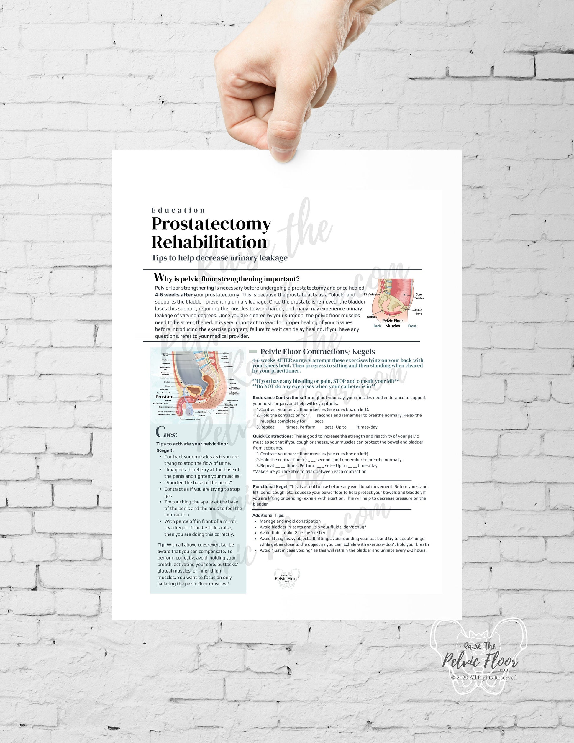 Prostatectomy Rehabilitation *Digital Download* Patient Education Handout- Pelvic Health, Prostate, Prostatectomy, Penis, Urine Leakage
