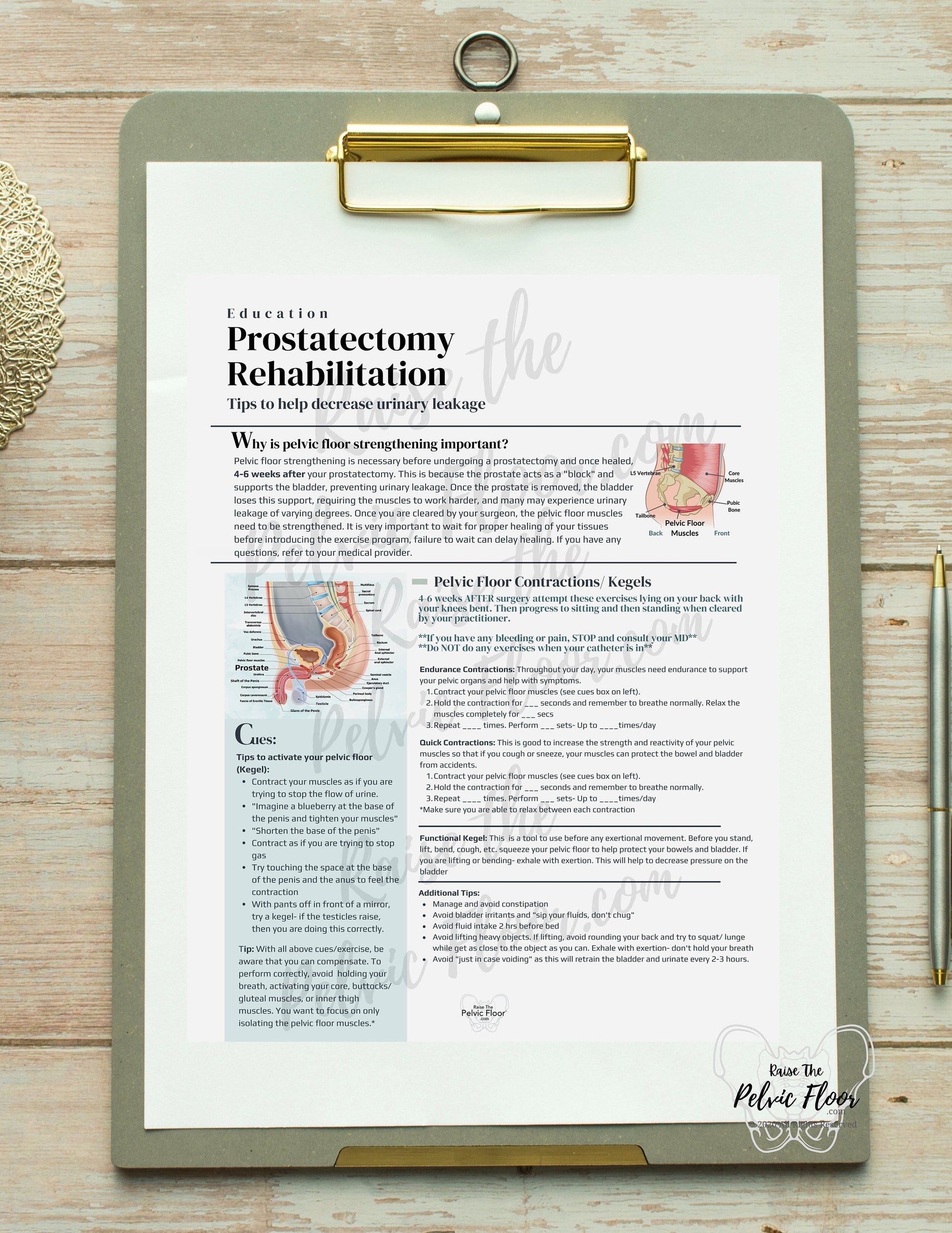 Prostatectomy Rehabilitation *Digital Download* Patient Education Handout- Pelvic Health, Prostate, Prostatectomy, Penis, Urine Leakage
